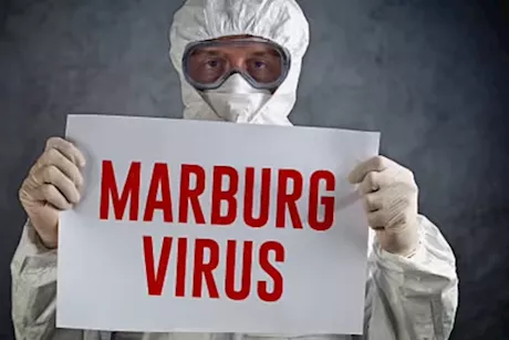 بعد انتشاره في إثيوبيا- هل وصل فيروس ماربورغ إلى مصر؟