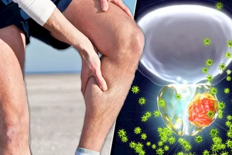 انتبه لساقيك- أعراض لسرطان البروستاتا قد تظهر عليهما