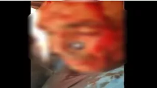   خلافات الجيرة تشعل مشاجرة بالسلاح الأبيض في الدقهلية