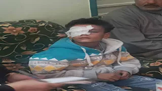 تحرك عاجل من محافظ قنا بعد اعتداء معلم كاد يتسبب في عاهة مستديمة لطالب