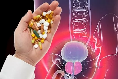 احذر- هذه المكملات قد تصيبك بسرطان البروستاتا