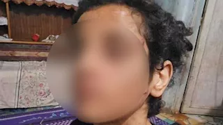 اعترفت على والدها وزوجته.. تفاصيل جديدة في واقعة تعذيب طفلة بالمنوفية