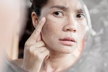 انتبه وجهك- 3 سرطانات تظهر أعراضها عليه