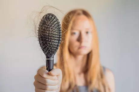 الأمراض التي تسبب تساقط الشعر- 7 مشكلات غير الصلع