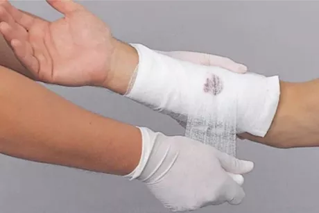 إسعافات أولية للقطع الوريدي.. وكيفية وقف النزيف؟ طبيب يوضح