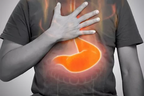 تحذير- انتشار عبوات مقلدة من دواء شهير لعلاج ارتجاع المريء