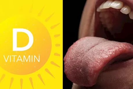 انتبه للسانك- 4 أعراض لنقص فيتامين د تظهر عليه