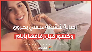إصابة شقيقة ميسي بحروق وكسور قبل حفل زفافها بأيام ..  ما القصة؟