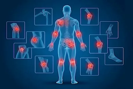 ما هي الآلام التي يسببها نقص فيتامين د؟