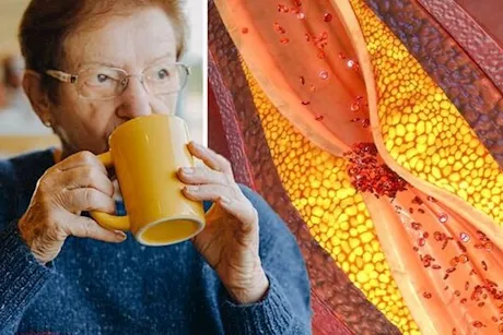 وداعًا للكوليسترول- 7 مشروبات صفراء تخفضه بسرعة