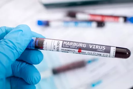 هل فيروس ماربورغ موجود في مصر؟- وزير الصحة يكشف