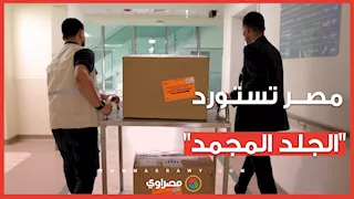 مصر تستورد أول شحنة من "الجلد المجمد" لعلاج الحروق