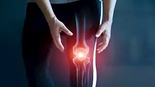 كيف تحمي نفسك من هشاشة العظام؟.. نصائح مهمة لهيئة الدواء