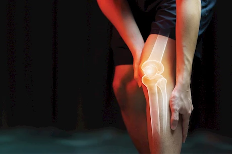أعراض خفية تهدد صحة العظام- تعرف عليها