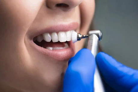 لتعزيز صحة الفم.. خبيرة تغذية تنصح بتناول هذه الأطعمة 