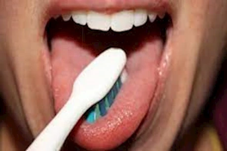 لهذه الأسباب- أحرص على تنظيف اللسان خلال غسل أسنانك 