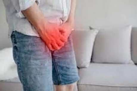 طبيبة تكشف- علاجات منزلية لالتهاب المثانة