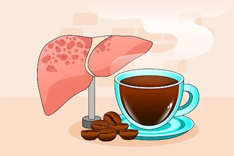 تستحق التجربة- 4 وصفات بالقهوة لعلاج دهون الكبد