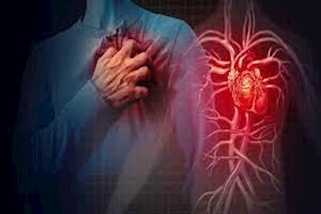 بدون أدوية.. أطعمة طبيعية تساهم في علاج انسداد الشرايين
