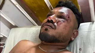 نجاة راكب واحد.. وفاة 241 من ركاب الطائرة الهندية المنكوبة