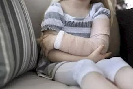 ما هو مرض العظام الزجاجية الذي يصيب الأطفال؟
