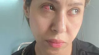 بسبب خطأ طبي.. إيناس عز الدين تخضع لعملية عاجلة في العين