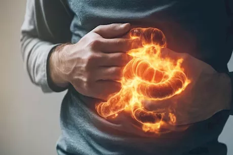 الفرق بين الحموضة والانتفاخ.. وماذا تأكل في الحالتين؟