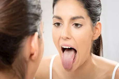 علامات على اللسان بعد شرب القهوة.. احذرها