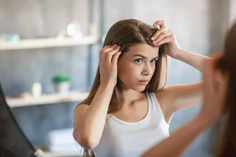 حروق الشمس بفروة الرأس.. إليك حلول منزلية فعالة