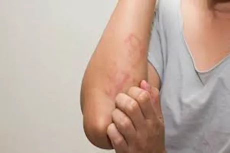 مرض سيلياك وحساسية القمح- ما الفرق بينهما؟