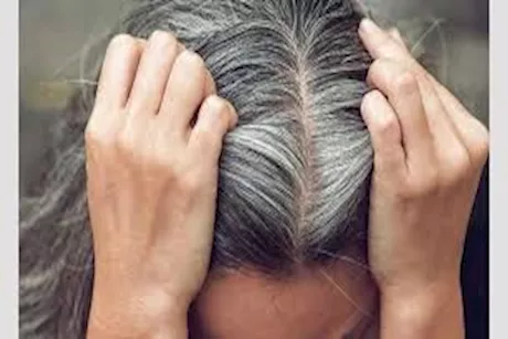 تعاني من الشيب المبكر؟- نقص هذه الفيتامينات قد يكون السبب