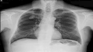 "أغرب من الخيال".. 25 صورة تكشف عن نتائج تحاليل طبية صادمة