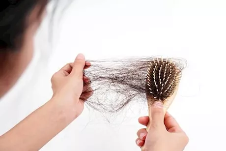 شعرِك يتساقط بكثرة؟- نقص هذه المعادن قد يكون السبب