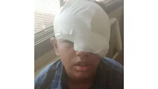 "أنا وشي باظ".. حكاية الطفل "معاذ" تنمر عليه زميله وشوه وجهه بـ"موس" في عزبة مدكور