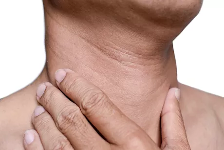 علام تدل الخطوط الداكنة في الرقبة؟