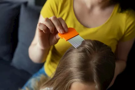 زيت فعال للتخلص من قمل الرأس عند الأطفال
