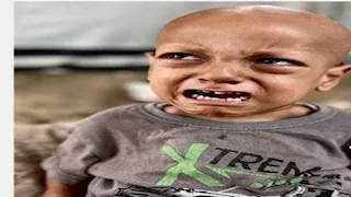 هز الضمير الإنساني.. وفاة الطفل الفلسطيني "عبد الله أبو زرقة" صاحب عبارة "أنا جعان"