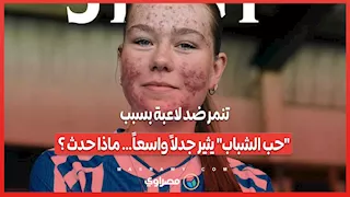 تنمر ضد لاعبة بسبب "حب الشباب" يثير جدلاً واسعاً… ماذا حدث ؟