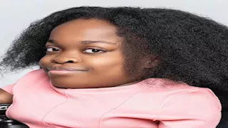 "الطول مجرد رقم".. 10 صور لأقصر عارضة أزياء في العالم تدخل جينيس