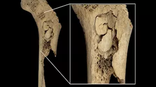 وليمة من لحوم البشر.. اكتشاف حادث مروع في إسبانيا "صور"