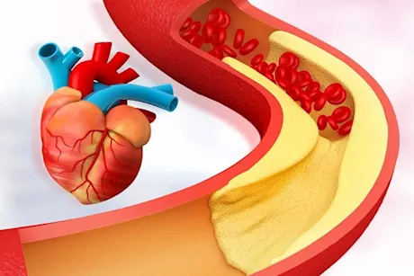 مثبتة علميًا- 4 مكملات غذائية لخفض الكوليسترول