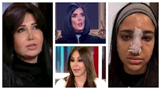 بعد أزمة كنزي مدبولي مع الفيلر.. 10 نجمات تعرضن للتشوه بسبب عمليات التجميل