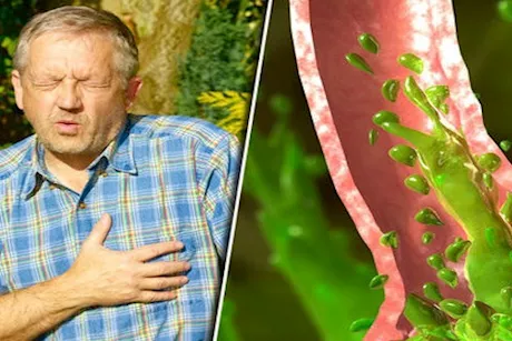 مضاعفاته خطيرة- دليل شامل عن ارتجاع الكبد