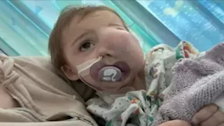 وفاة "أجمل طفلة في العالم" بسبب كتلة على وجهها.. ما القصة؟