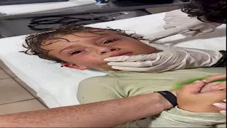 طبيب يستخرج سرطان بحر حي من أذن صبي- فيديو صادم 