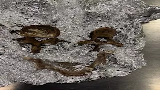 جمجمة وفقرات بشرية في حقيبة سفر أحد الركاب.. ما القصة ؟