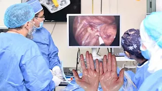 "مبرة طنطا ترسم البهجة".. 120 عملية ناجحة لعلاج تعرق اليدين عند الأطفال