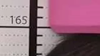 مراهق ينفق آلاف الدولارات على علاج لزيادة الطول.. لكن المفاجأة كانت صادمة