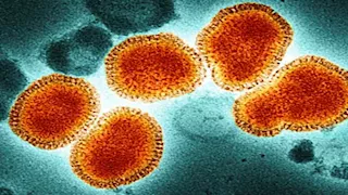 بعد ظهوره في بريطانيا.. أعراض وطرق الوقاية من فيروس H5N1 