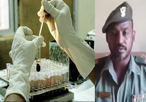 "الجيش السوداني" يعلن عن إكتشافه علاج ناجح لمرض الايدز